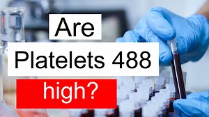 Is Platelet count 488 high, normal or dangerous? What does Platelet count level 488 mean?