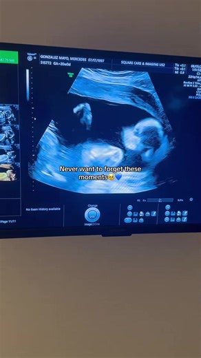 Had our 20 week anatomy scan this week and it was the most amazing experience of my life!👶🏼🍼 I absolutely melt when I see our little baby boy and hearing his heartbeat is the best s | News style