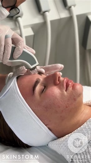 SYBARIS | It's Valentine’s Day is this Saturday 💘 Yay! A Sybaris Beauty gift voucher for our Skinstorm Facial is a guaranteed win — advanced skin... | Instagram