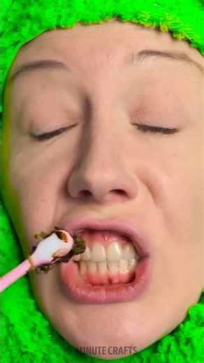 From Simple to Sparkling ✨ Stunning Tooth Gem Makeover