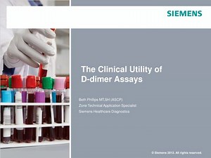 The Clinical Utility of D-dimer Assays - SlideServe