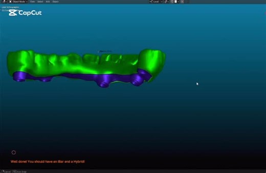Bakr ibrahim on Instagram‎: "#dentaltechnology exocadofficial #dentalstudent # #dentaltechnican #dentallab #dentalassistant #dentalimplants# #dentalimplants #dentalcare #dentalhygiene #dentaldesign ##exocad_training #egypt #jordon #lebanon #iraq #طلبه_اسنان_الازهر #morroco #makkah #riyadh #jeddah #tunisia #albania #dental_student #unitedkingdom# #unitedstates #unitedarabemirates #united_dental_labor #tunisie #russia #unitedkingdom"‎
