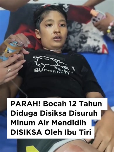😭Bocah 12 tahun di Sukabumi diduga disiksa ibu tiri, bahkan dipaksa minum air panas mendidih 🥲🥲 Kasus ini viral dan keluarga menuntut keadilan. Semoga anak‑anak selalu aman dari kekerasan! 🕊️ #Sukabumi #KekerasanAnak #JusticeForNS #StopChildAbuse #nizam
