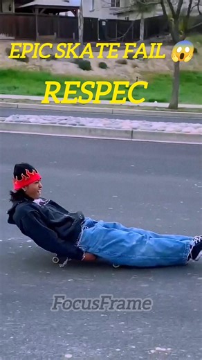 Skating Tricks Gone Wrong 😱 । #skating