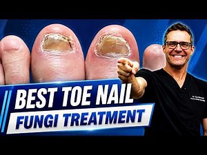 Toenail Fungus? Try These Doctor-Approved Treatments To Clear Your Nails
