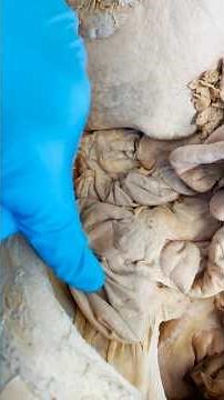 Where Your Appendix is Really Located