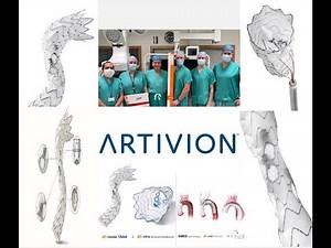 Launch of First Artivion-iBevar-E-nside TAAA Endograft at Galway University Hospital, Ireland