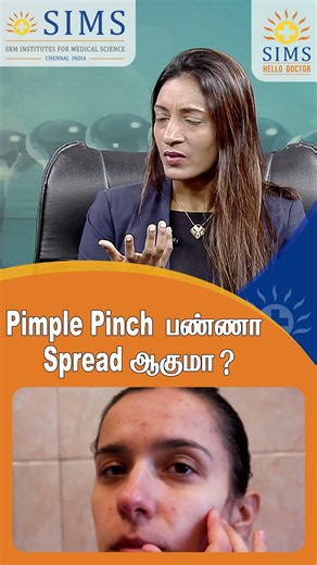 Does Pinching Pimples Make Them Spread? | Hello Doctor