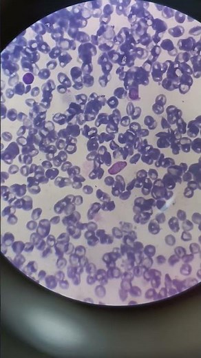 plasmodium vivax under microscope.