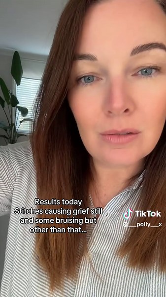 Understanding Oophorectomy Results and Healing Process