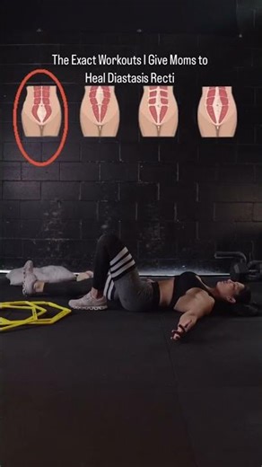 No One Tells You This 🤍 Exact Diastasis Recti Workouts || #postpartum #core #mom #coreworkout