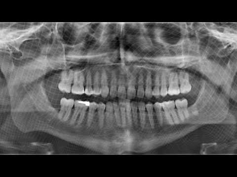 Herobust - Move Mint (Official Full Stream)