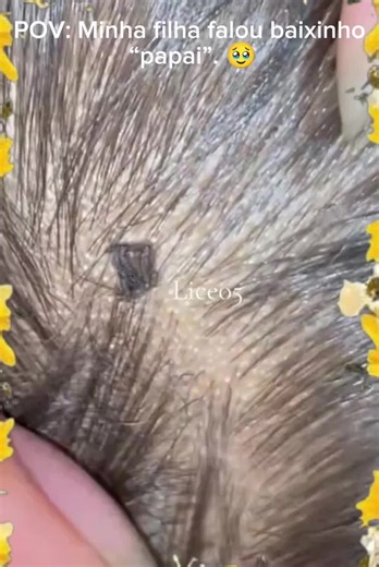 Lice removal demonstration — Brazil TikTok growth challenge