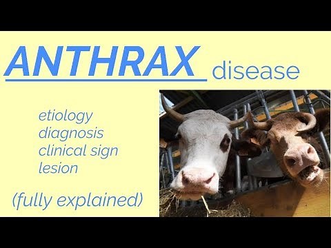 ANTHRAX | disease | etiology | transmission | clinical sign | Diagnosis |