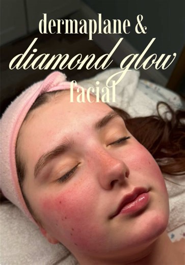 Diamond glow and dermaplane facial with our amazing aesthetician Vanessa! 🧖🏻‍♀️🫶🏼✨💉 #MedSpa #medspaasmr #glowyskin #spatok #aesthetics
