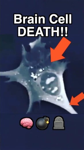 Real footage of BRAIN CELL DYING | Doctor Explains! #science