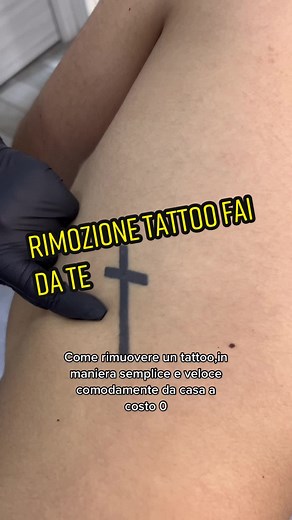 how to remove a tattoo from home without cost 👌🏻