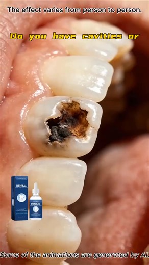 🔥 50% OFF RIGHT NOW — YOUR TEETH NEED THIS ARMOUR (DON’T WAIT!) ⏰Sick of cavity scares, sensitive teeth that CRINGE at cold drinks, or dentist bills that empty your wallet (for fixes that come TOO LATE)? 🦷😫 INTRODUCING TOOTH ARMOR DROPS — the FLUORIDE-FREE, DENTIST-BACKED GAME-CHANGER that REBUILDS ENAMEL ON FIRST USE 🤯✅ ✅ KISS CAVITIES GOODBYE… FOREVER (clinically PROVEN — no more fillings!) ✅ DITCH the drill/pain: repair & strengthen at home (2 MINS/DAY — ZERO effort!) ✅ NO harsh chemicals