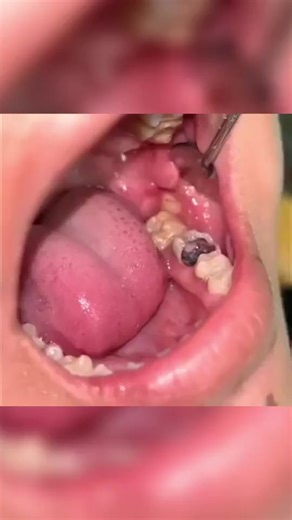 BBOJI™ Whitening Toothpaste — Powered by advanced mineral micro-cleanse technology, it deeply removes surface stains while protecting enamel. The refreshing mint formula strengthens teeth, balances oral pH, and restores your natural white shine — for a confident, radiant smile every day. ✨ | Dr. Ethan Marlowe