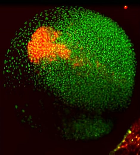 zebrafish embryo development visualized with light sheet microscopy