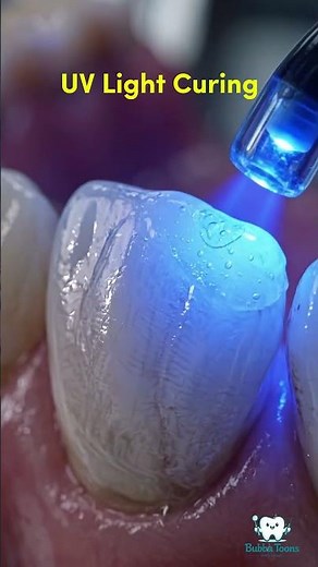 Watch This Chipped Tooth Get Perfectly Restored #dental