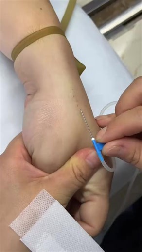 Witness the incredible skill of "flying needle" technique! #MedicalSkills #NurseTikTok #FlyingNeedle | health is priceless