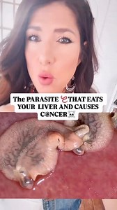 These parasites can live undetected in the bile ducts & your liver for years, silently causing damage. Over time, they can lead to: Gallbladder issues ! Liver problems And often, they can show up as cancers The WHO classifies liver flukes as a Group 1 carcinogen which is the same category as smoking. PubMed studies have linked them to bile duct cancer and other serious diseases. If you’ve ever eaten raw fish, sushi , or been exposed to contaminated water, you could be at risk. These parasites ar