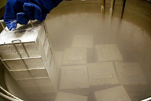 A Frozen Bunny Brain Takes The Prize | Neuroscience