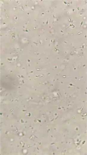 🧼 Soap Under a Microscope… This Is SHOCKING! 🔬