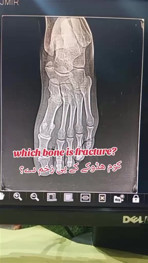 Understanding the Wrist Joint Anatomy