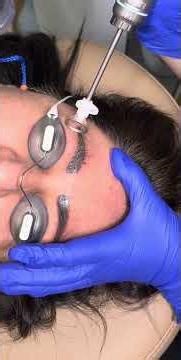 Microblading Tattoo Removal | Fix Old or Uneven Brows | Southlake TX Medspa