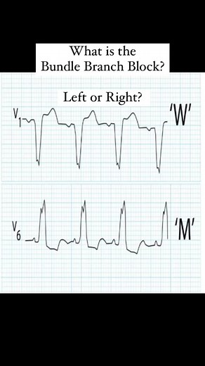 We offer all the American Heart Association (AHA) courses - BLS, ACLS, PALS, HeartSaver. In person courses. We also offer an outstanding Online Private EKG tutoring with dr Tobias Araujo, an MD cardiologist, who will teach you in a simple and easier way, whatever you wish to learn. Hands On Heart is located in northern Staten Island (NYC), close to Brooklyn, Manhattan, New Jersey, Queens… Book your class in our website (Link in BIO) #handsonheart #bls #ahabls #ahapals #pals #acls #ahaacls #heart