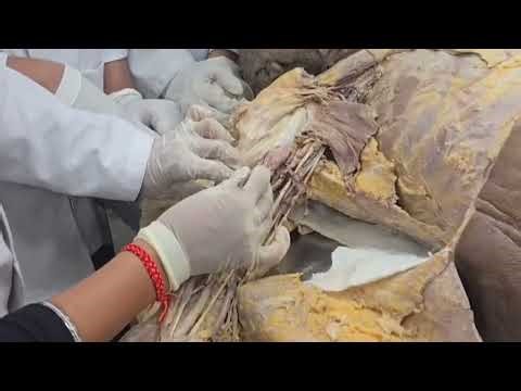 Arm Flexor Compartment | Very Fast Revision for Viva Exam👆#flexor 