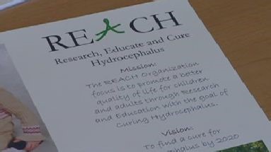 Researchers Continue Work to Find Cure for Hydrocephalus