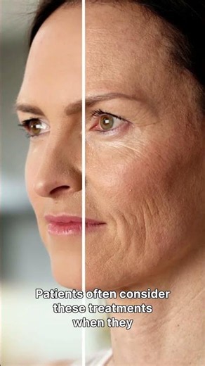 XERF vs Ultherapy: What's the Difference?