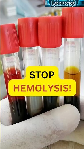 3 Simple Ways To Prevent Sample Hemolysis 🔬 #medtech #phlebotomy