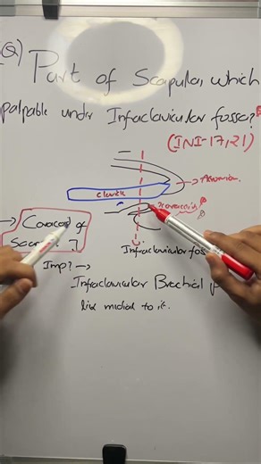 What’s the part of scapula which is palpable in Infraclavicular fossa?