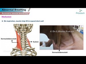 Abnormal Breathing 🫁 Accessory Muscle Breathing, Agonal, Apneustic, Asterixis and Ataxic Breathing 🫁