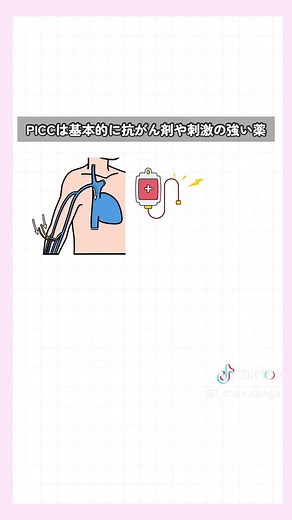 カテーテルの種類と特徴を学ぼう