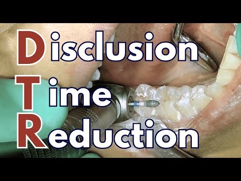 Can Occlusal Adjustment Cure TMD? 'DTR' and T-Scan Experience - PDP255