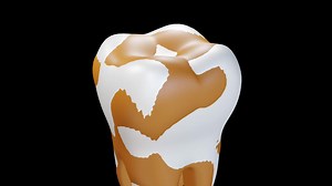 Download Dirty teeth 3d animation for free