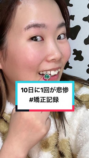 なつみかん 歯並び矯正記録：インビザラインの半年後の変化と悲惨な日々
