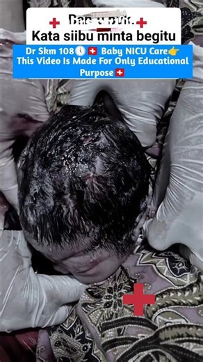 Shocking Birth Moment 😱 Baby’s Head Pulled Out Suddenly#birthmoment#viralshort#newbornbaby#tiktok