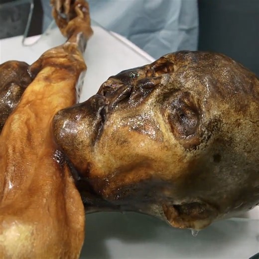 Killed over 5,000 years ago, Ötzi the Iceman is Europe’s oldest known natural mummy. Watch scientists try to solve the mystery of his death: | NOVA l PBS
