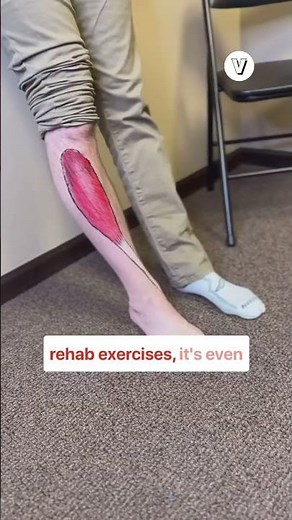 How to get rid of shin splints.