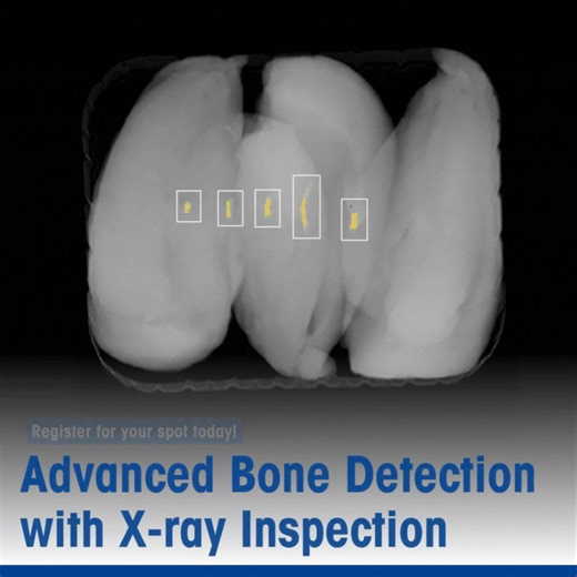 Don't forget to secure your place in our 'Advanced Bone Detection...