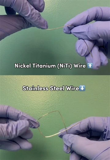 Understanding NiTi and Stainless Steel Wires in Orthodontics