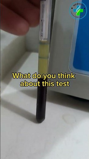 ESR test | Erythrocytes sedimentation rate | hematology