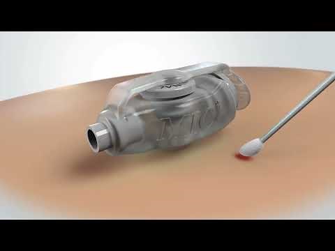 MIC KEY GJ Tube Maintenance and Stoma Care