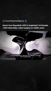 Neuralink’s robot carefully places each tiny thread (thinner than a human hair) into the brain. It avoids blood vessels with amazing accuracy and works fully on its own The procedure is gentle, leaves almost no mark, and lets people with paralysis move cursors, play games, and communicate again - just by thinking This is how thoughts control technology | Artificial Intelligence News